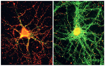 Sin insulina (izquierda): Aglomerado de péptidos, en rojo, se adhieren y eliminar las sinapsis neuronales (puntos verdes). Sin insulina: grupos (puntos rojos) desaparecen y preserva las sinapsis de las neuronas activas