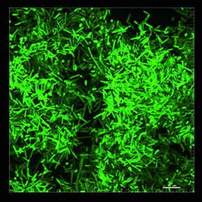 Bactérias vivas, com mutação fluorescente, no microscópio confocal