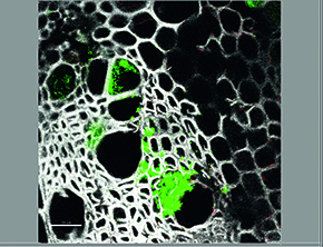 Xylem (green) colonized by Xylella fastidiosa 