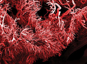 Tangled network: microscopic image of the blood vessels of an intestinal tumor