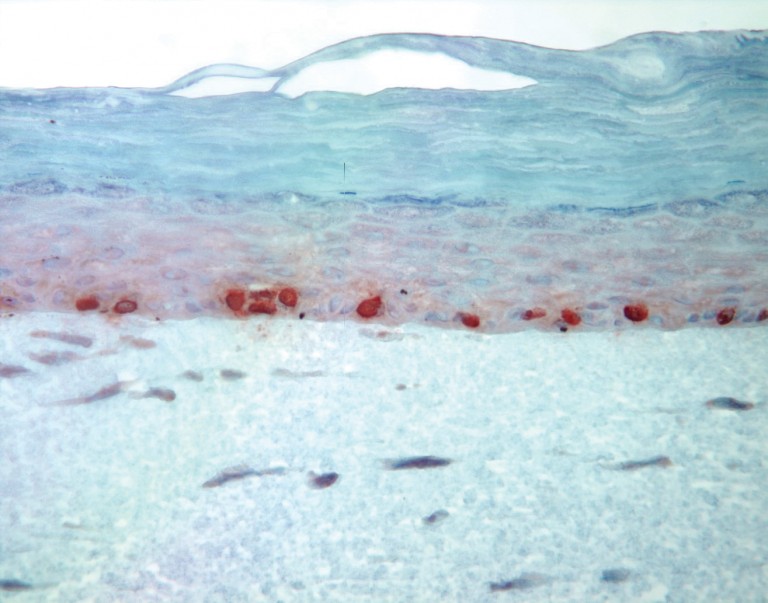 ...e a pele artificial normal, em experimentos no Instituto de Ciências Biomédicas (ICB)