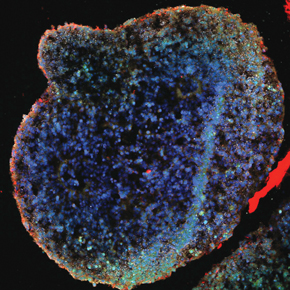 Minicerebro generado a partir de una célula de la piel: una herramienta para estudiar la actividad de neuronas