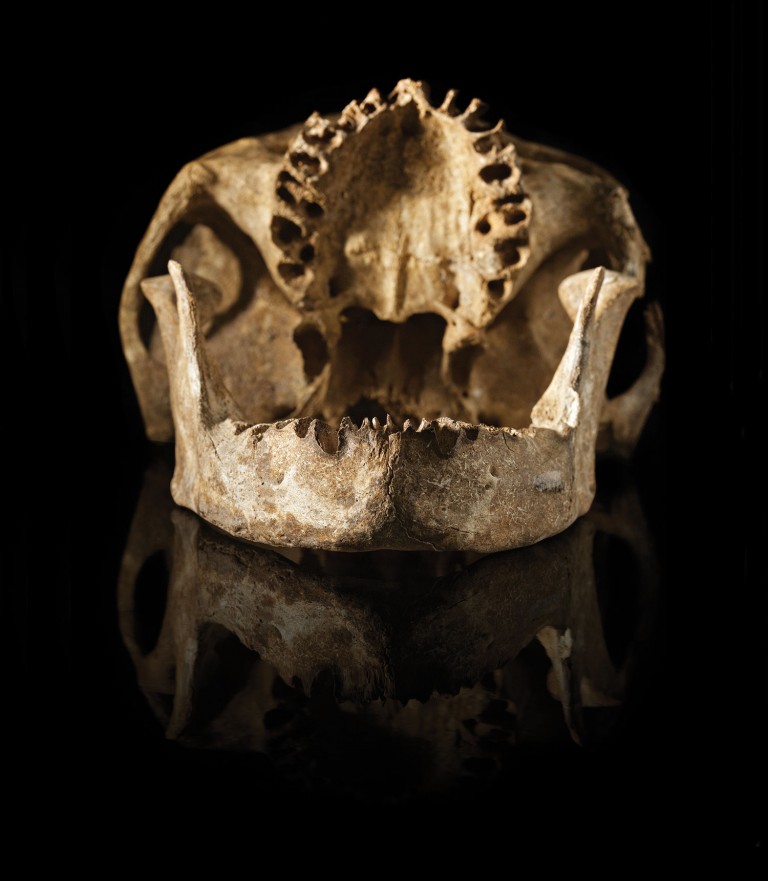 Crânio com dentes removidos ...