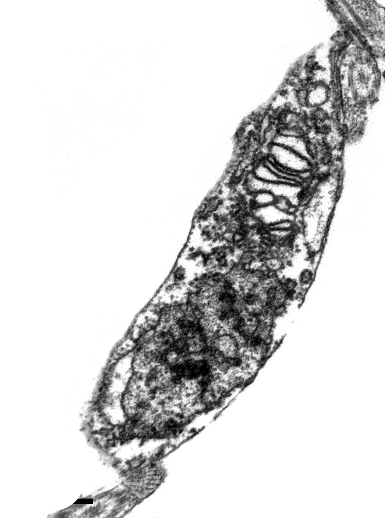 In a transmission electron microscope, two snapshots of Trypanosoma cruzi under the effect of the drug sertraline: after 30 minutes...