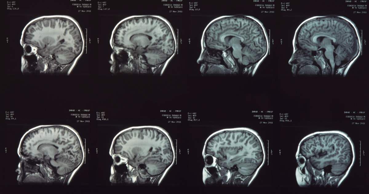Estudo mapeia evolução do cérebro ao longo da vida Revista Pesquisa Fapesp
