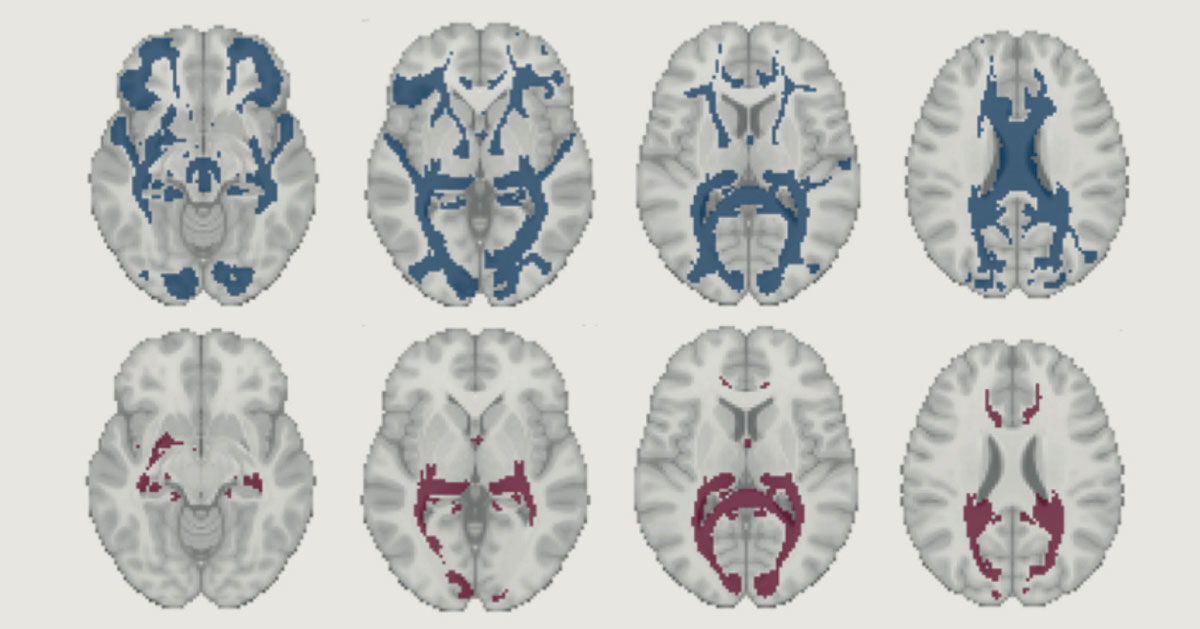 Estruturas cerebrais mudam durante ciclo menstrual : Revista