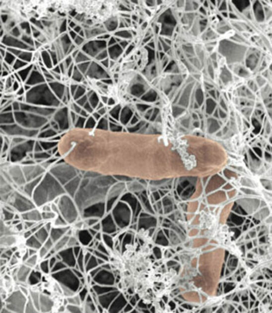 Bacteria in heart valves Revista Pesquisa Fapesp