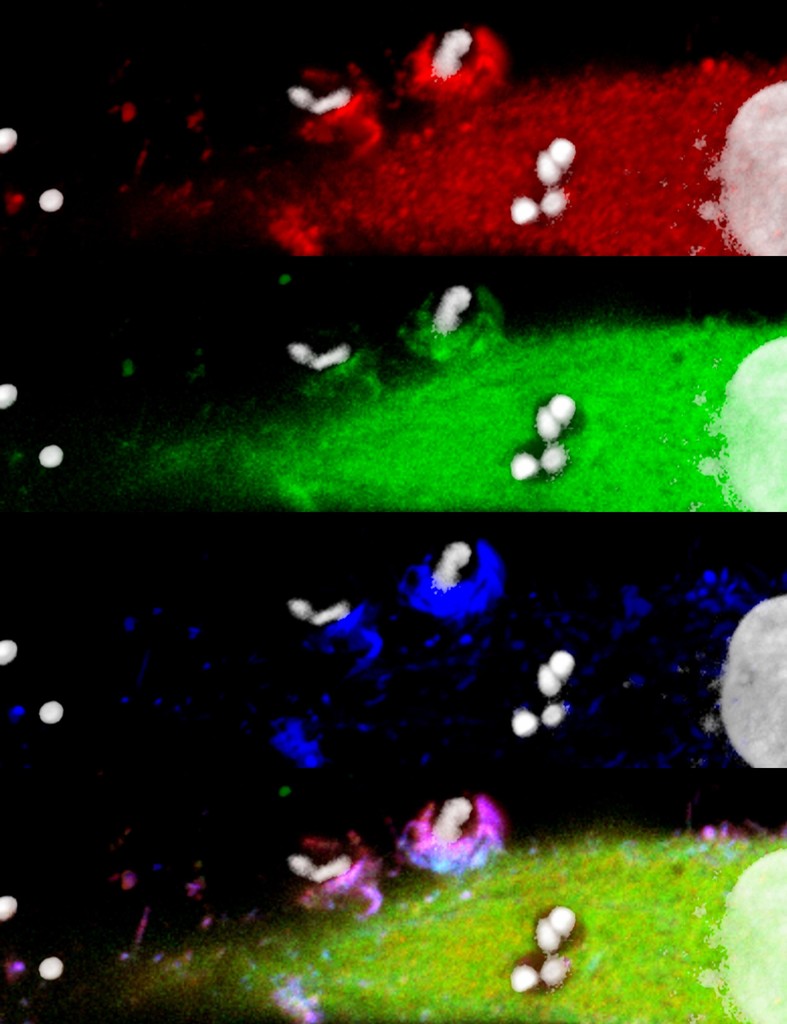 Imagem obtida por microscopia confocal mostra recrutamento de moléculas de células hospedeira pelo Trypanosoma cruzi. A cortactina da célula HeLa (vermelho) e a proteína quinase D1-GFP (verde) são recrutadas, formando uma espécie de taça que envolve o parasita, trazendo-o para dentro da célula (azul)