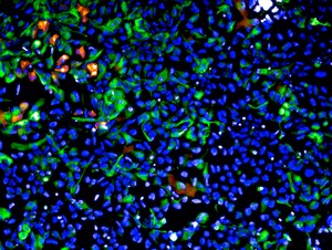Núcleos das células cerebrais (azul), axônios em formação (verde) e o vírus zika (laranja) destacados em cultura bidimensional