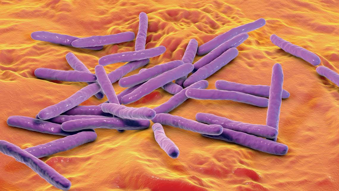 Hanseníase: o que é, causas, sintomas e tratamentos – Nova Diagnóstico por  Imagem